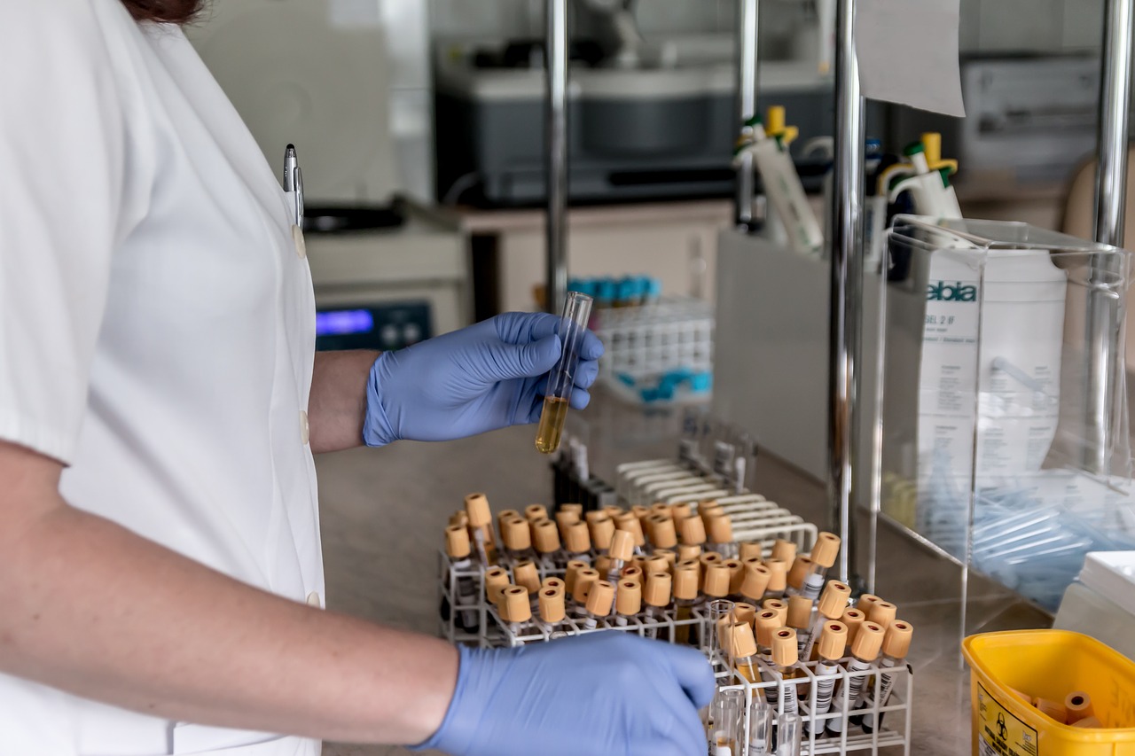 В Самаре разрабатываются тест-системы оценки эффективности противовоспалительных лекарств
