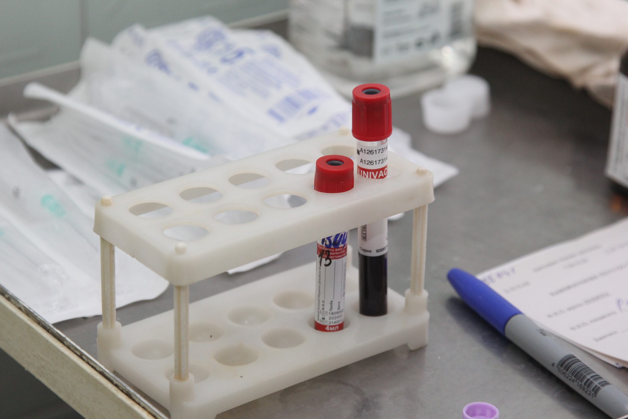 Самарские ученые учатся изготавливать препарат из донорской плазмы крови