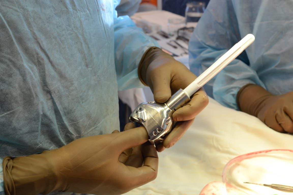 В Казани пациенту заменили часть пораженной опухолью кости протезом производства СамГМУ